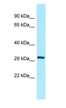 SFTPA2 / Surfactant Protein A2 Antibody (aa70-119)