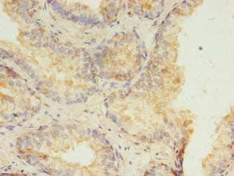 HMGN3 Antibody