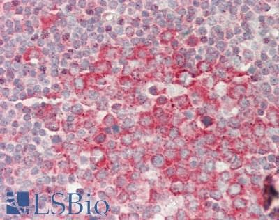 Polyclonal Rabbit anti-Human RAPGEF1 Antibody (aa866-915, IHC, WB)