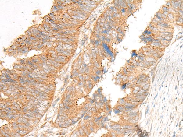 GLIS1 Antibody