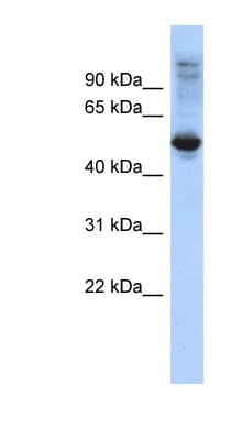 FBXL16 Antibody (C-Terminus)