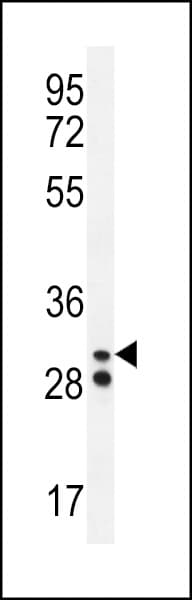 HNE / Neutrophil Elastase Antibody (aa13-39)