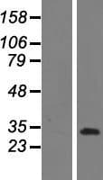 CCDC3 Protein (Over-Expression Lysate Myc-DDK (Flag))