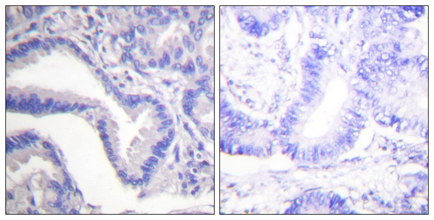 CASP7 / Caspase 7 Antibody (Cleaved-Asp198)