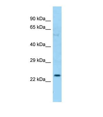 CFHR2 Antibody (C-Terminus)