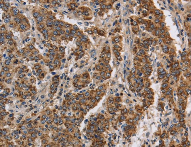 Polyclonal Rabbit anti-Human KCNQ4 Antibody (IHC, WB)
