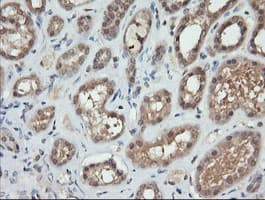 TRMT2A Antibody (clone OTI2C6)