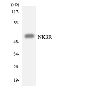 Polyclonal Rabbit anti-Human TACR3 / NK3R Antibody (aa385-434, WB)