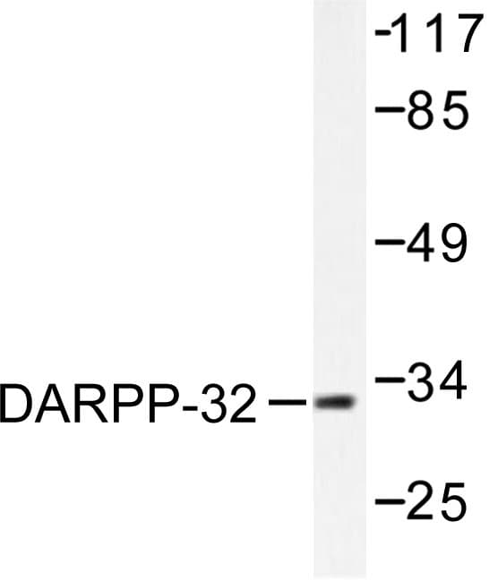 PPP1R1B / DARPP-32 Antibody (Pro69)