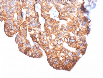 ERBB2 / HER2 Antibody (clone ERBB2/2452)