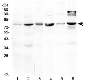 Polyclonal Rabbit anti-Human HSD17B4 Antibody (IHC, WB)