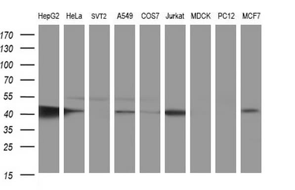 TXNDC5 / ERP46 Antibody (clone OTI1D4)