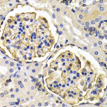 KLKB1 / Plasma Kallikrein Antibody