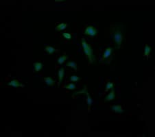 MDM4 / MDMX Antibody (clone OTI4D2)