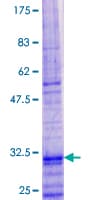 Human TSLP Protein (Recombinant GST)