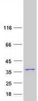 Human SUMF2 Protein (Recombinant Myc-DDK (Flag))