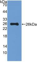 MUC5B Antibody (aa75-295)