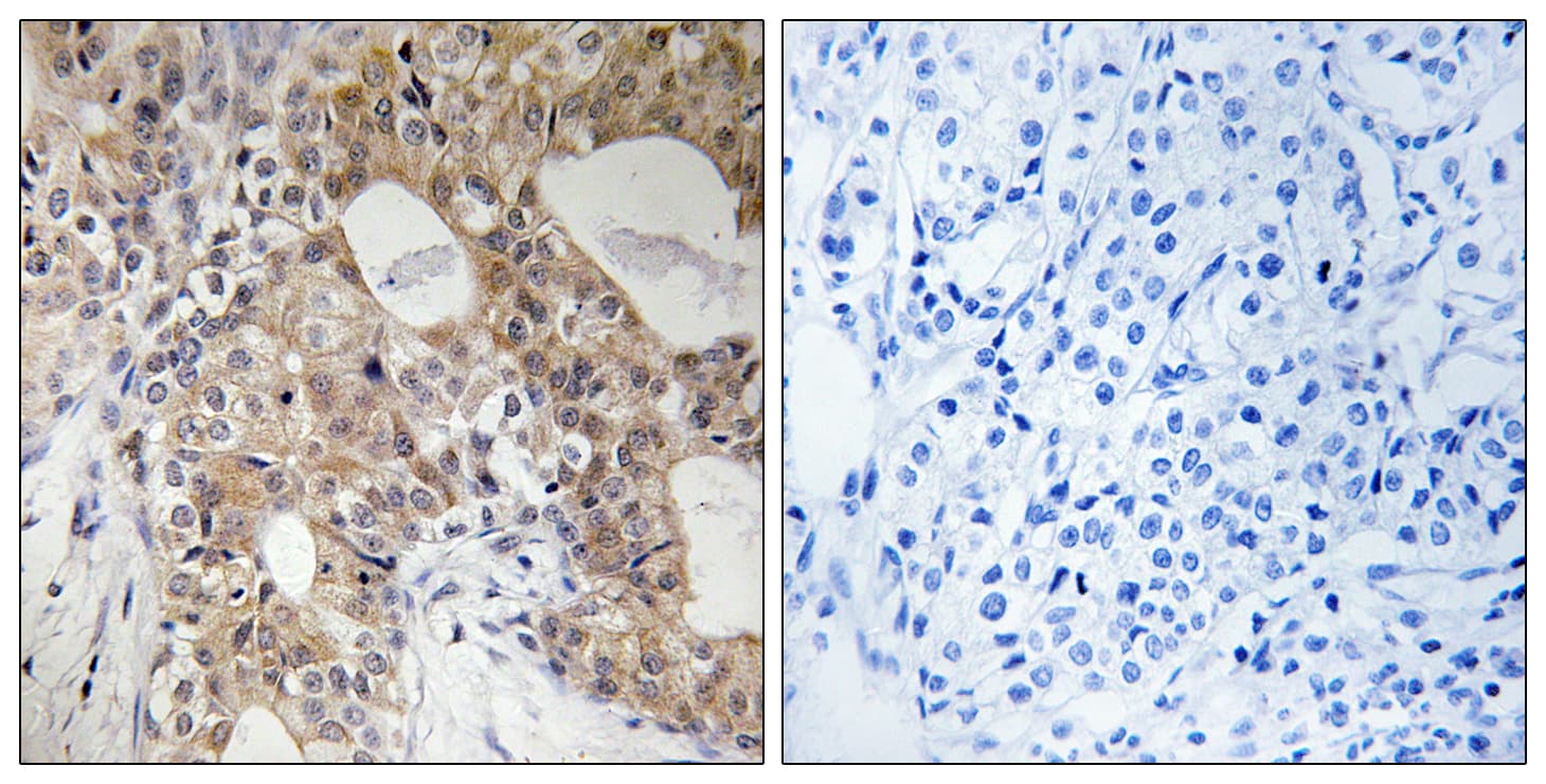 Polyclonal Rabbit anti-Human SPHK2 Antibody (phospho-Thr614, IHC)