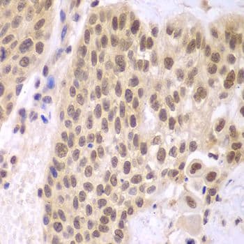CSNK2A2 Antibody