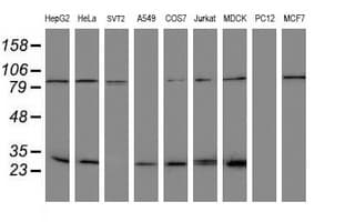 NQO2 Antibody (clone OTI1G2)