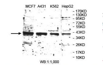 TARBP2 / TRBP2 Antibody (aa38-281)
