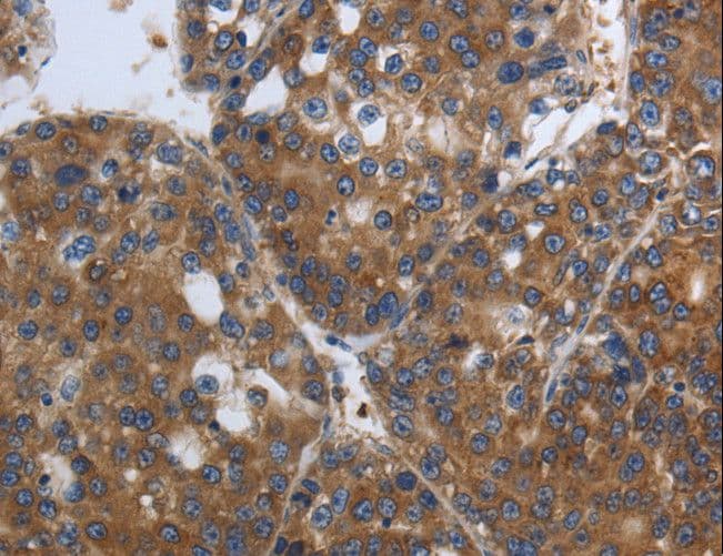 Polyclonal Rabbit anti-Human SOCS1 Antibody (IHC, WB)