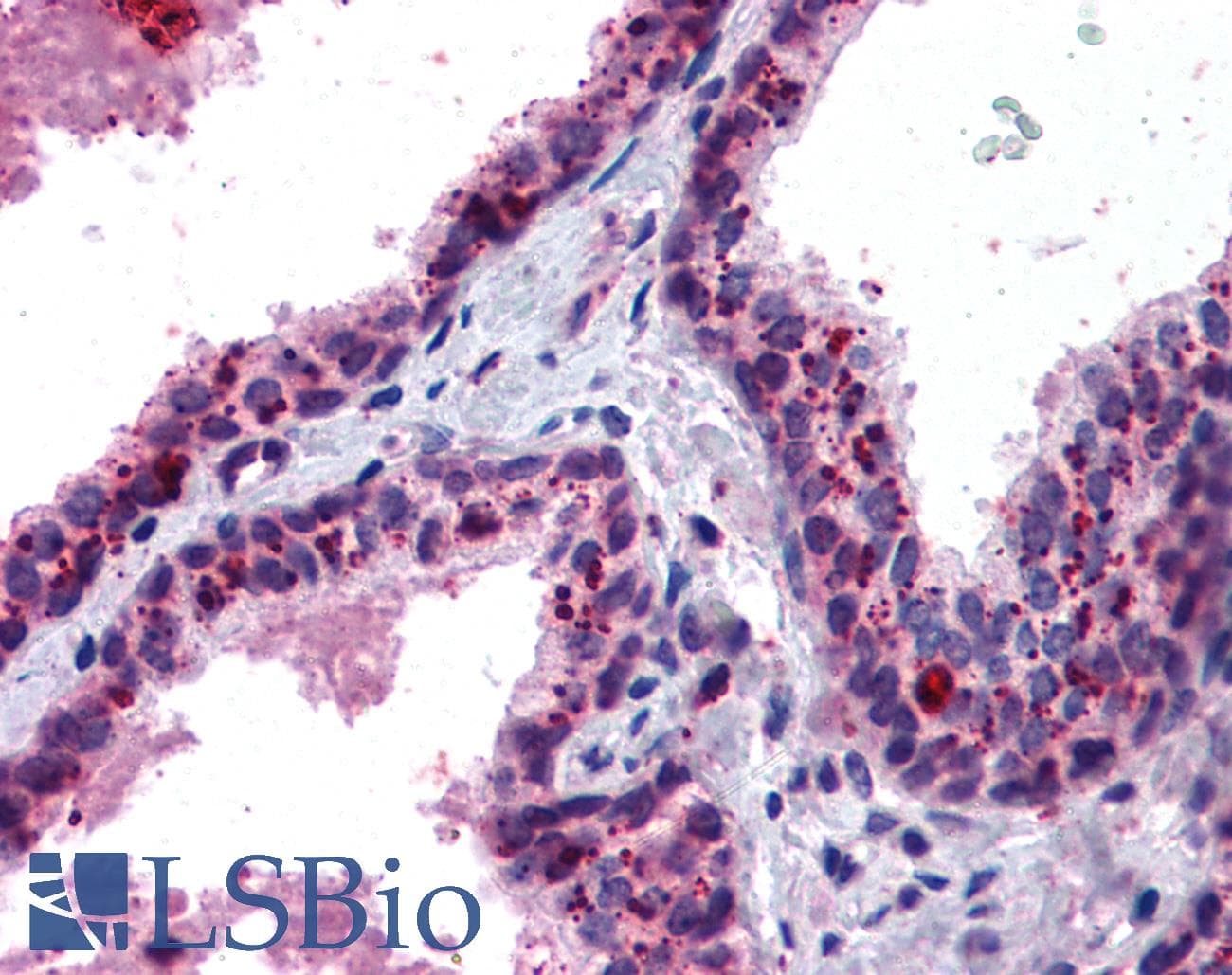 IHC-plus™ PADI1 Antibody