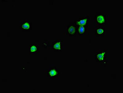 Polyclonal Rabbit anti-Human MTERF4 / MTERFD2 Antibody (IHC, IF, WB)