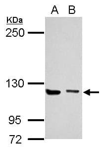 UNC13D Antibody (aa1029-1090)