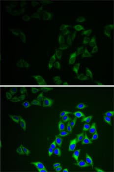 Polyclonal Rabbit anti-Human AK1 / Adenylate Kinase 1 Antibody (IHC, IF, WB)