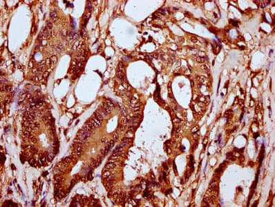 HIST1H2BN Antibody