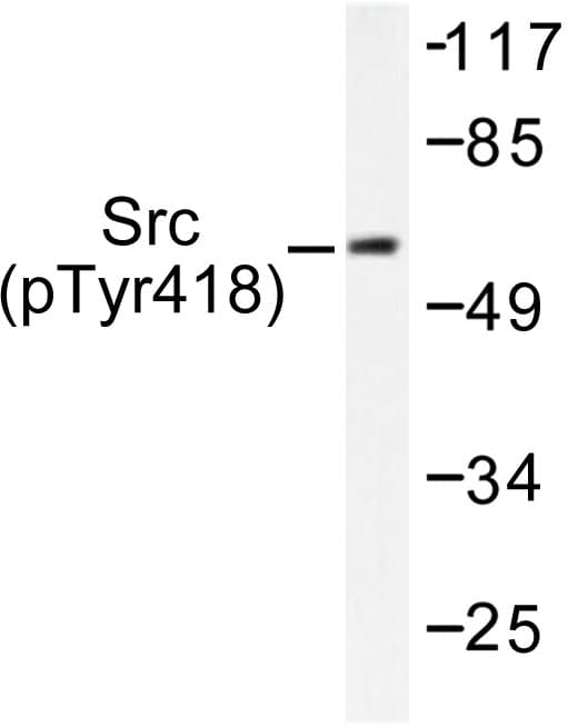 Polyclonal Rabbit anti-Human SRC Antibody (phospho-Tyr418, IHC, WB)