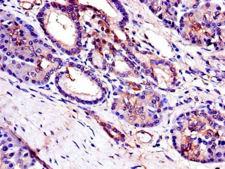 Polyclonal Rabbit anti-Human TRB3 / TRIB3 Antibody (IHC)