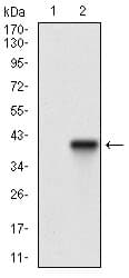 PathPlus™ ACP5 / TRAP Antibody (aa221-325, clone 5C5E7)