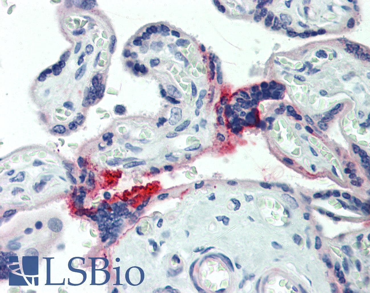 IHC-plus™ HAS3 Antibody (aa137-164)