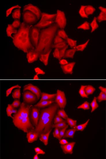 Polyclonal Rabbit anti-Human SLC26A2 Antibody (IHC, IF, WB)