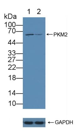 PKM / Pyruvate Kinase, Muscle Antibody (aa141-248)