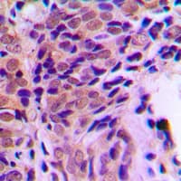 Polyclonal Rabbit anti-Human NR3C1/Glucocorticoid Receptor Antibody (phospho-Ser211, IHC, WB)