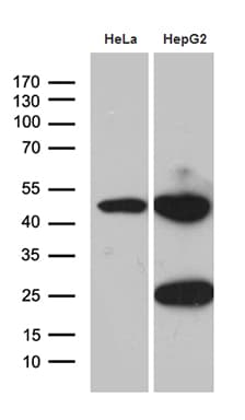 Monoclonal Mouse anti-Human MCAD / ACADM Antibody (clone OTI9G10, Carrier-free, IHC, WB)