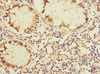 DUSP16 / MKP7 Antibody