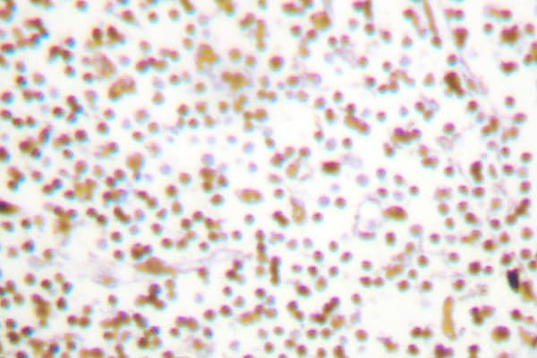 POU2F1 / OCT1 Antibody (Leu68)