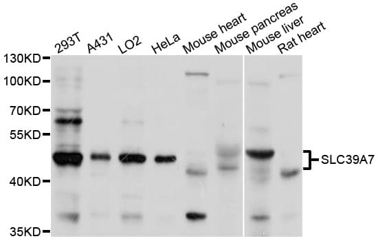 SLC39A7 / ZIP7 Antibody