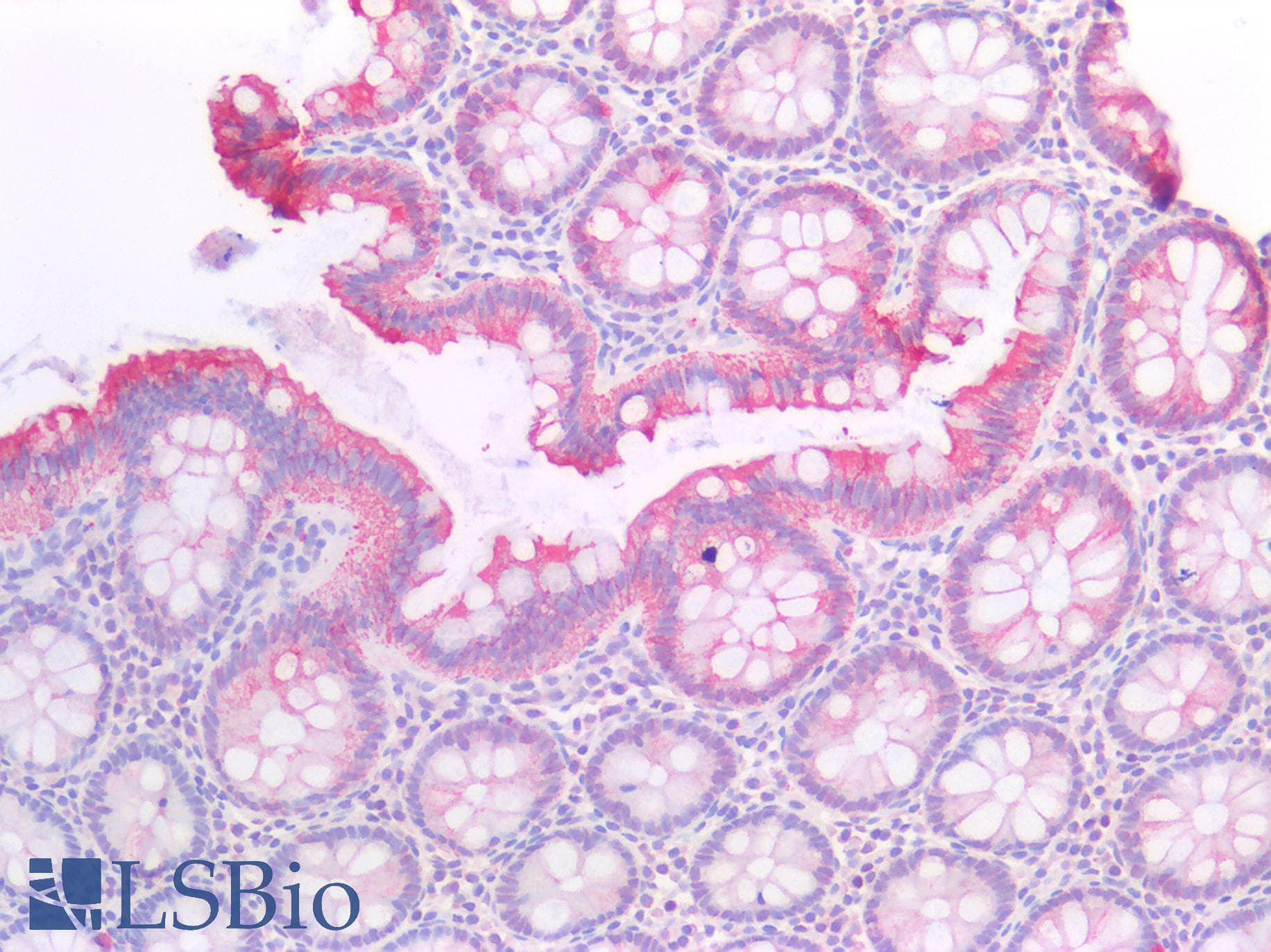 IHC-plus™ Polyclonal Rabbit anti-Human KRT20 / CK20 / Cytokeratin 20 Antibody (aa75-317, IHC, IF, WB)