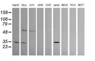 PROSC Antibody (clone OTI1G2)