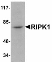 IHC-plus™ RIPK1 / RIP Antibody