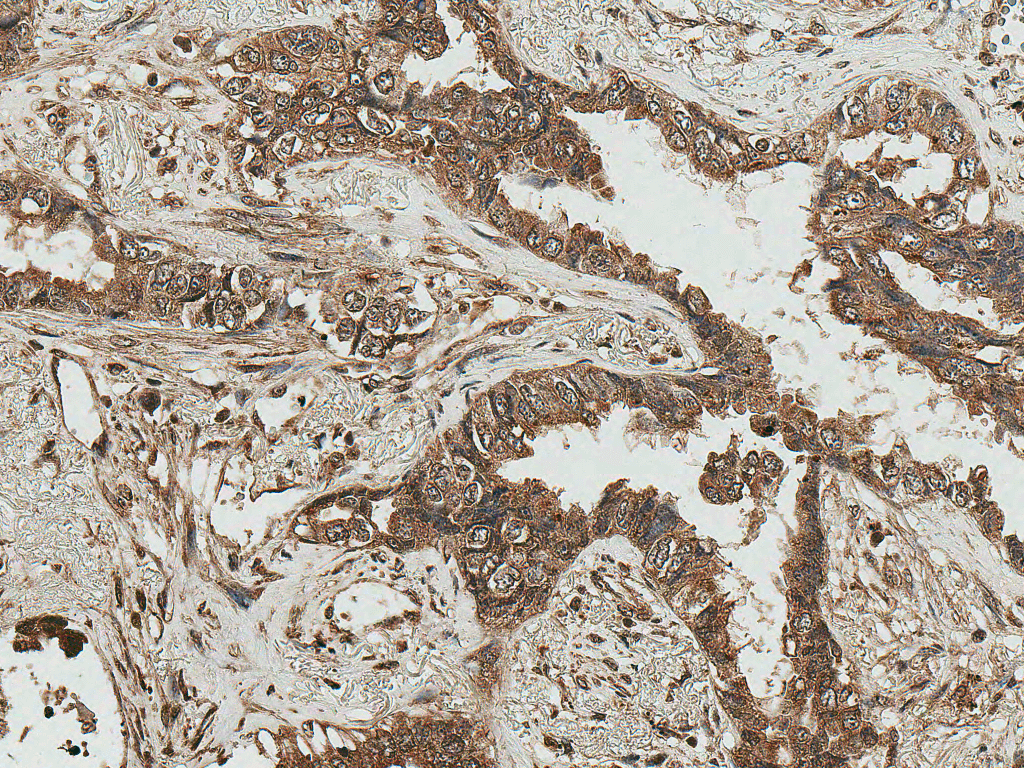 RICTOR Antibody (SA)