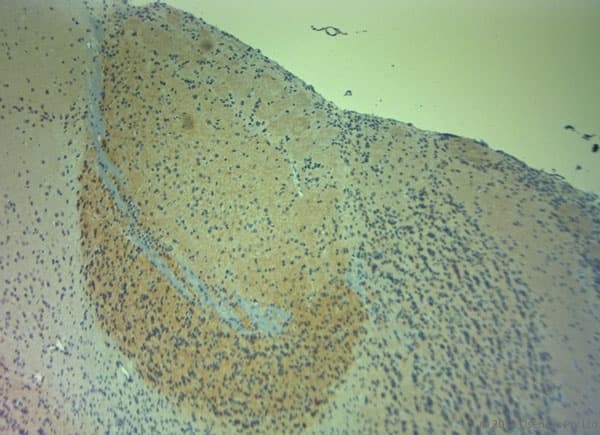 Polyclonal Rabbit anti-Human NOS1 / nNOS Antibody (aa1390-1434, IHC)
