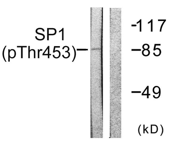SP1 Antibody (phospho-Thr453)