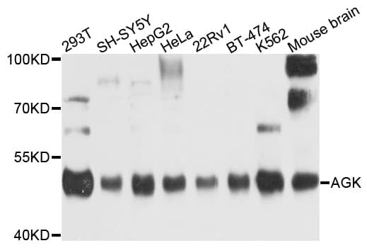 AGK Antibody