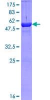 Human EXOSC5 Protein (Recombinant GST)